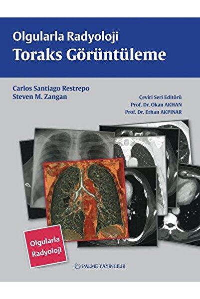 Palme Yayıncılık Olgularla Radyoloji Toraks Görüntüleme / Carlos Santiago Res...