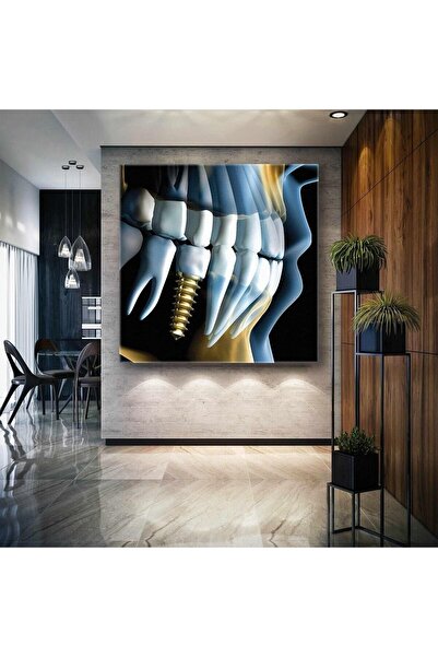 Tuval Sepeti Imprimare pe pânză pentru biroul dentistului Implant de aur pent...