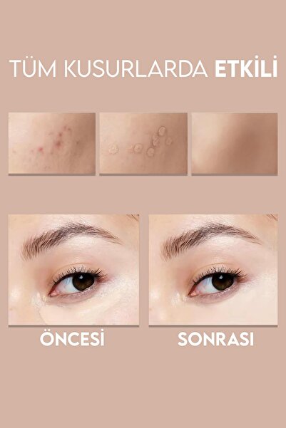 MUJGAN Orta Ton Liquid Matte Sıvı Gözaltı Kapatıcı