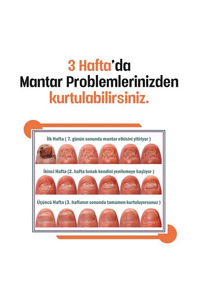 BİTKİZEN Care Cream for Hands, Feet, Nails and Fungi