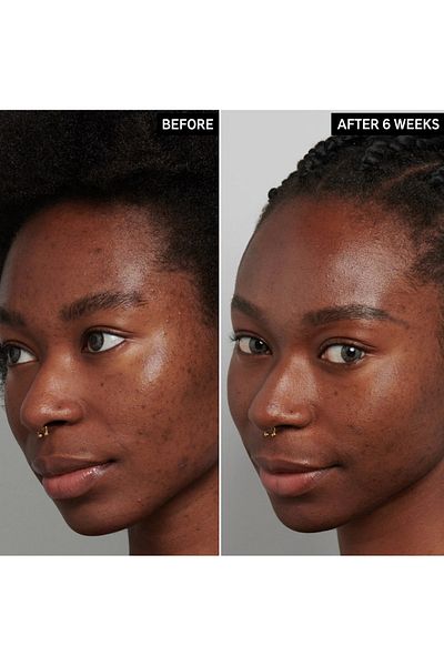 THE INKEY LIST 30 Ml Tranexamic Acid - Hyperpigmentation Treatment