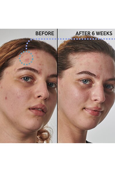 THE INKEY LIST SuperSolutions 10% Urea Moisturizer Textured Skin Solution 50 Ml