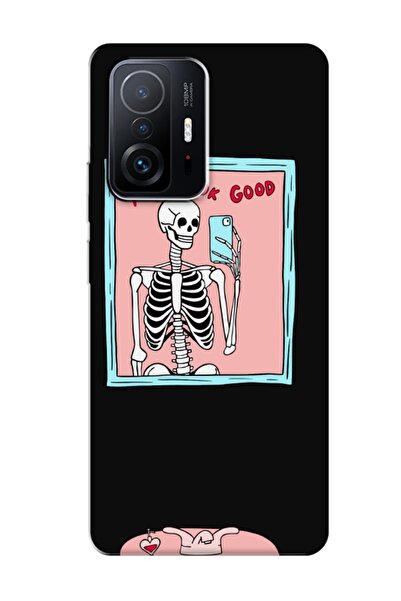 frondcase حافظة هاتف Xiaomi Mi 11t Pro You Look Good هيكل عظمي أسود