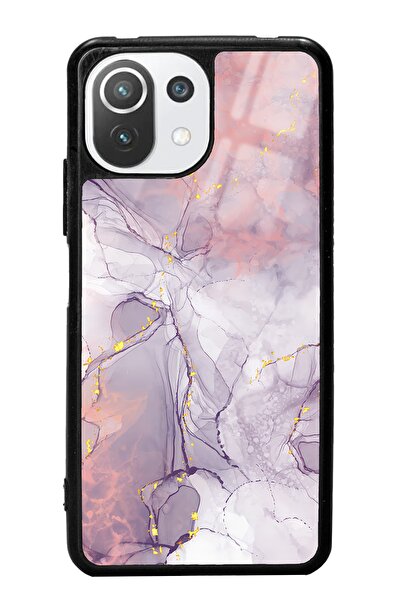 Spoyi Xiaomi Mi 11 Lite Fuşya Mermer Tasarımlı Glossy Telefon Kılıfı