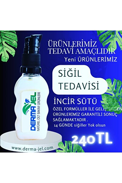 Siğil Tedavisi