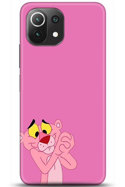 Turkiyecepaksesuar Xiaomi Mi 11 Lite Case Hd Printed Case - Followed Institut...