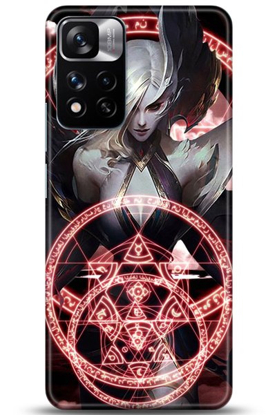 Noprin Xiaomi Redmi Note 11 Pro Plus 5g Case Hd Printed Case - Followed Insti...