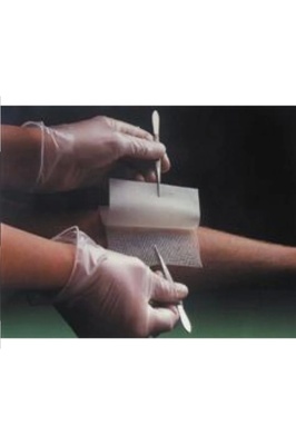 Smith Nephew Bactigrass Antiseptik Tül Gras Sargı 10cmx10cm ürün fotoğrafı