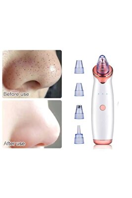 Şarjlı Derma Suction 40 Kpa Vakumlu Siyah Nokta Ve Yüz Temizleme Cihazı (ALETİ) ürün fotoğrafı