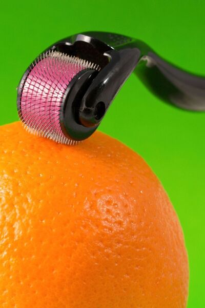 Чешел за раст на коса - Derma Roller со титаниумски игли за обновување на кожата 0.5 mm