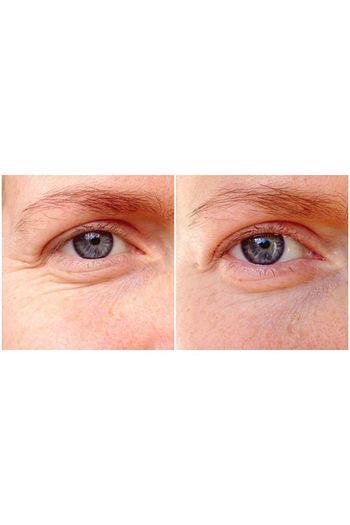 Dr Murad Dr Murad Resurgence Retinol Youth Trendyol
