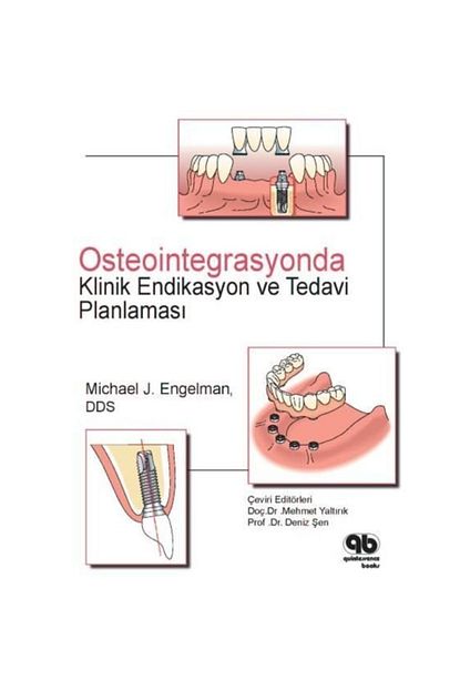 Quintessence Yayincilik Osteointegrasyonda Klinik Endikasyon Ve Planlama Ceviri Editorleri Mehmet Yaltirik Deniz Sen Trendyol