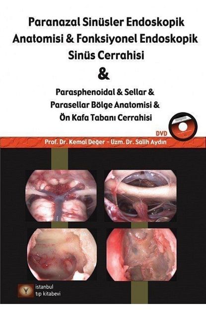 Istanbul Medikal Yayincilik Paranazal Sinusler Endoskopi Anatomisi Ve Fonksiyonel Endoskopik Sinus Cerrahisi Dvd Li Trendyol