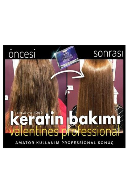 botox sac bakimi