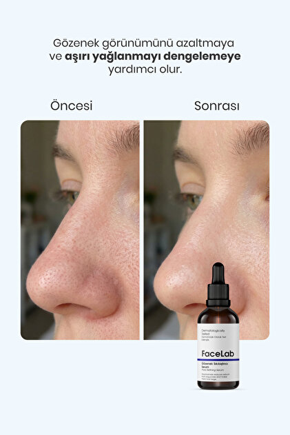 FaceLab Gözenek Sıkılaştırıcı Görünüm Destekli Serum – Niacinamide