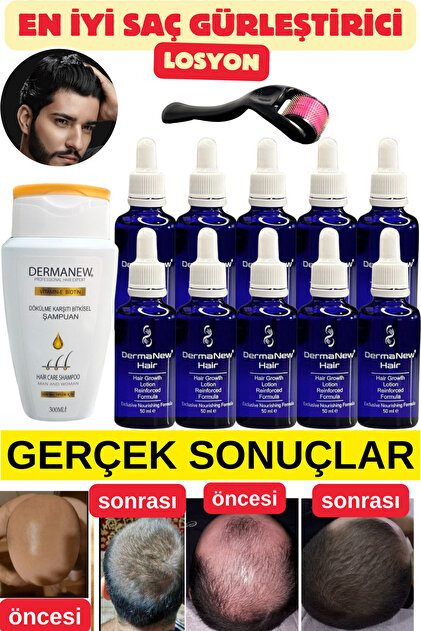 dermanew hair Sac Bakim - Saç Dökülmesi - Saç Uzatıcı - Sac Serumu