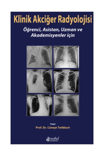 Klinik Akciğer Radyolojisi