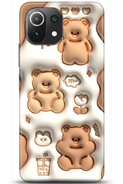 Xiaomi Mi 11 Lite Case HD Printed Case - Followed Institution 5047