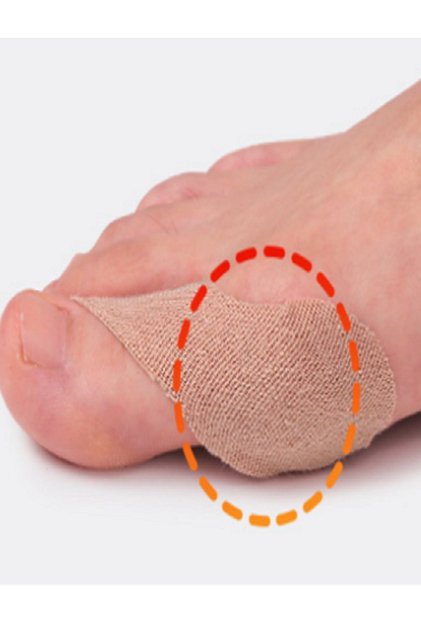 5 Pairs of Orthopedic Valgus Thumb Tendon Cover and Finger Protection Band