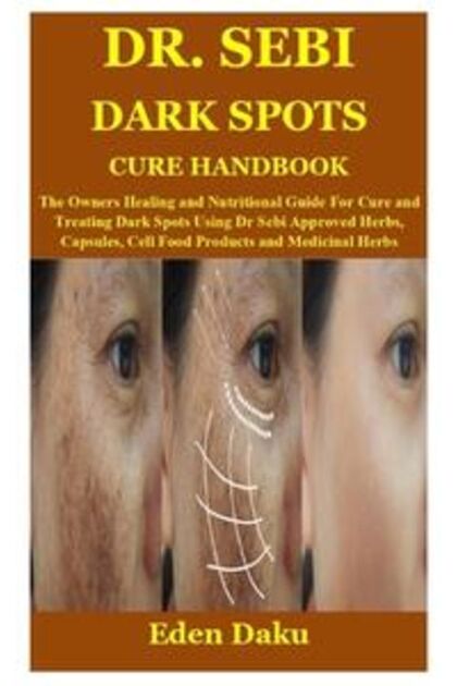 Dr Sebi Dark Spots Cure Handbook The Owners Healing And Nutritional Guide For Cure And Treating Da
