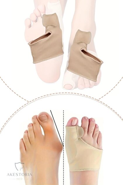 Çift Baş Parmak Kemik Düzeltici Ve Koruyucu Makarlı Unisex Fc-038