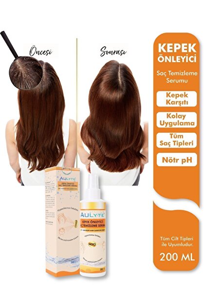 Aulyte Kepek Önleyici Saç Temizleme Spreyi 200 ml Fiyatı, Yorumları