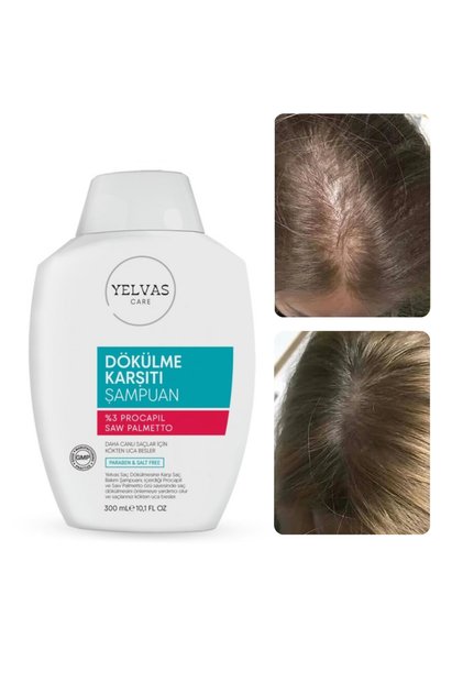 Procapil, Saw Palmetto, Ve Biotin Içerikli Saç Dökülmesine Karşı Şampuan 300 ml