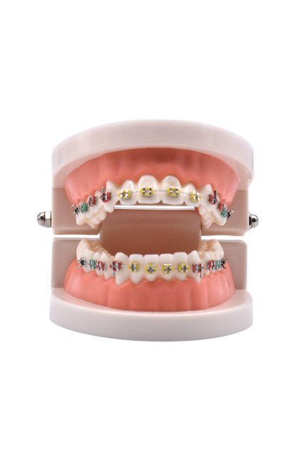1pcs Dental Orthodontic Treatment Teeth Model With Bracket Arch Wire Buccal Tube Ligature Ties Denti
