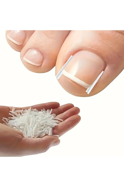 Batık Tırnak Düzeltici Plastik Şeritler 10 Adet