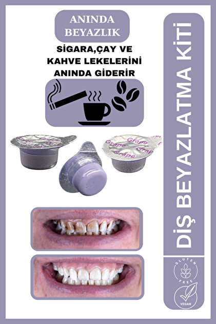 AVANT DENTAL SUPPLY 3 Tüp Diş Beyazlatıcı Üzüm Aromalı Sigara Çay