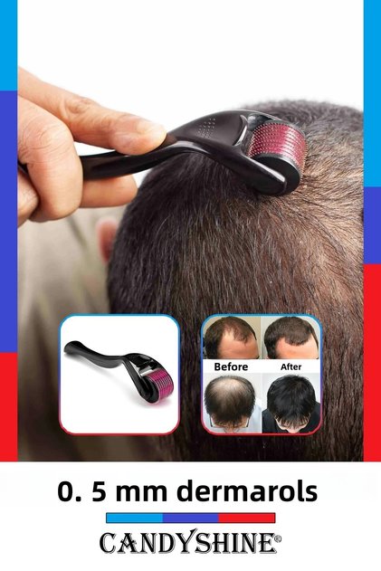 0.5mm 540 Needle Dermaroller Hair Strengthening Skin Care Tool