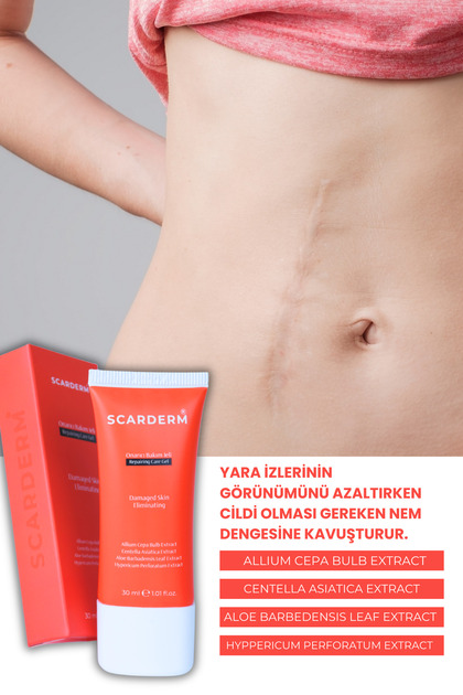 aloe vera pflanze wie nutzen Tipps zur Pflege deiner Pflanze : Aloe Vera – PflanzenFuerAlle main image 1