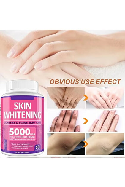 homocysteine glutathione Skin Glutathione Whitening Pills