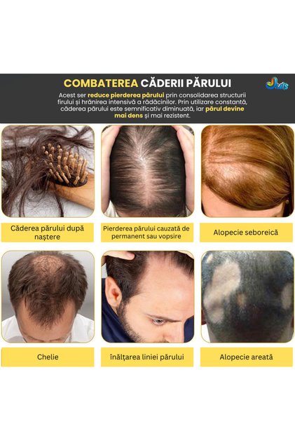5 x Ser de păr cu biotină, pachet de 5 — Tratament creștere rapidă, întărește parul, opreste caderea
