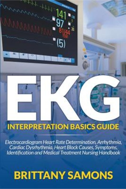 Ghid de bază pentru interpretarea EKG: Determinarea ritmului cardiac pe electrocardiogramă, aritmie, disfuncție cardiacă