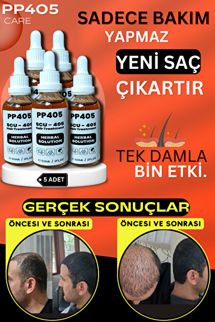 Saç Çıkartıcı Saç Gürleştirici Dökülme Karşıtı Anti-Hair Loss Oluşumu Saç Serumu 5 Adet