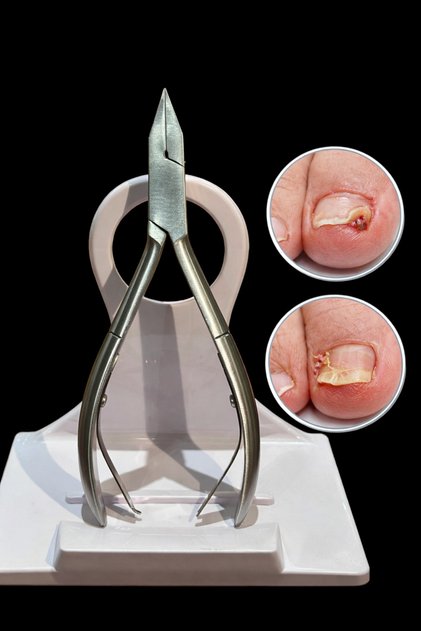 Batık Tırnak Pensi-Podoloji pensesi 13CM