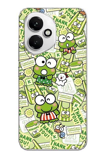 Honor 400 Compatible Cute Frog Pattern Transparent Phone Case