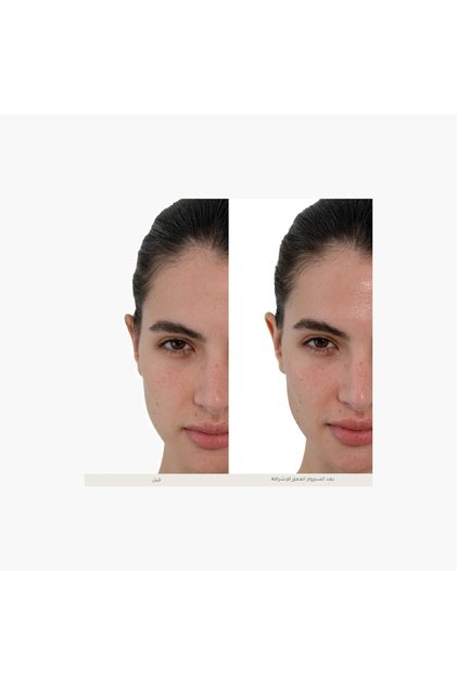 سيروم لوكا سكين الأساسي لتعزيز الإشراق