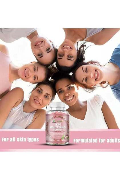 khanyi mbau skin lightening glutathione injections Khanyi says women should accept their dark skin