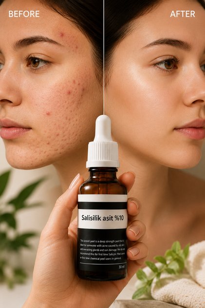 Effective Skin Care Against Acne, Blackheads, and Large Pores with 10% Salicylic Acid Serum