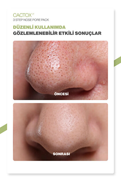 Dr.Melaxin 3 Aşamalı Siyah Nokta Temizleyici ve Gözenek
