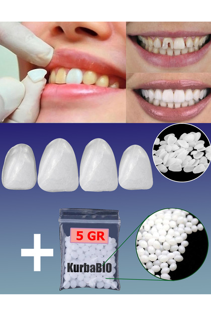 5 Gram Pro Thermo Granül ve Üst Çene 4 Adet Ön Diş Protez Diş Kaplaması, Kırık Diş Onarımı, Çürük Diş ve Çatlak Diş Kaplama