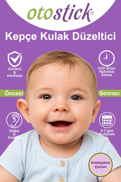 Baby Bebek Çocuk Kepçe Kulak Düzeltici