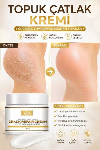 Moisturizing Care Cream for Feet, Heels, Cracks, Fungi, Odors and Diabetic Sores