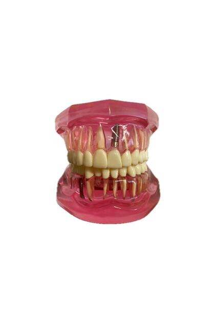 Implant Köprü Model