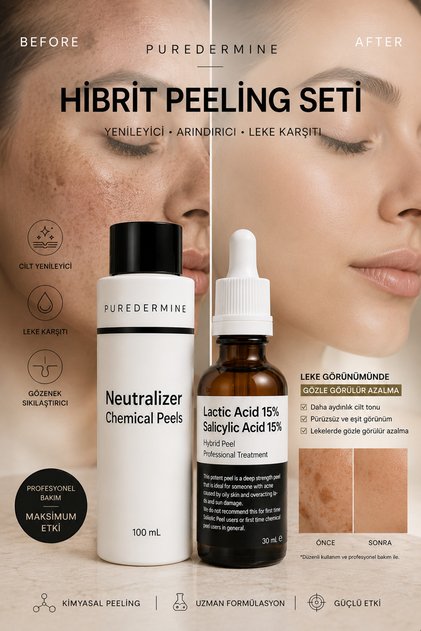 Set of 2 Hybrid Peel 15% Lactic Acid 15% Salicylic Acid Aha Bha Professional Chemical Peeling Pore Cleanser Skin Renewal Care Solution