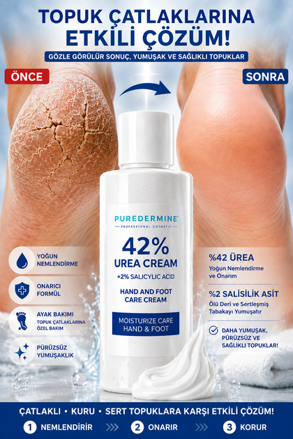 %42 Urea Cream Topuklarınıza Hak Ettiği Bakımı Verin: %42 Üre ile Yoğun Nem, %2 Salisilik Asit ile Pürüzsüzleştirici Bakım