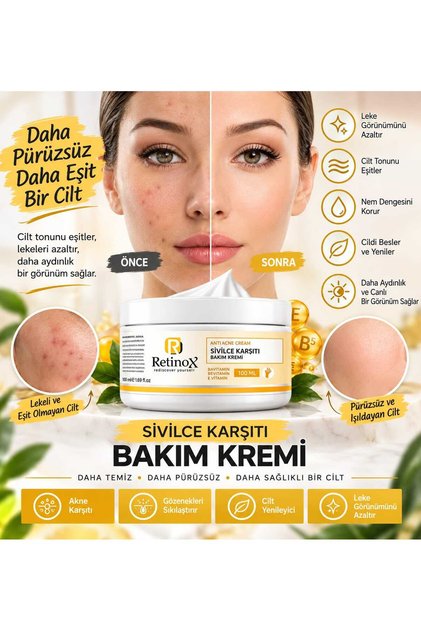 Anti-Pimple Cream Containing Vitamins, Blackhead Pimple - Anti-Acne, Blemish Removal Facial Cream 100ml