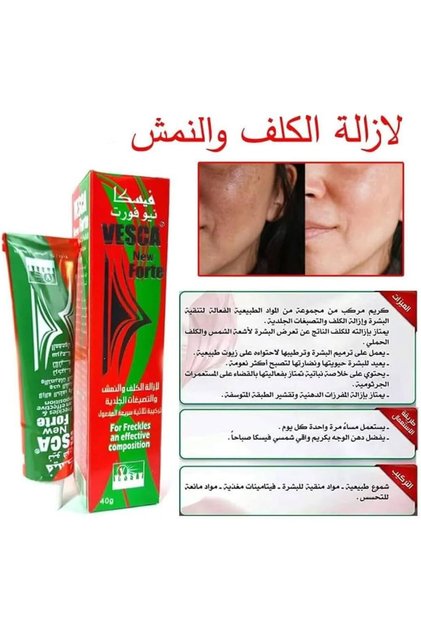 كريم فيسكا نيو فورت بلس (Vesca New Forte Plus) لإزالة التصبغات والنمش